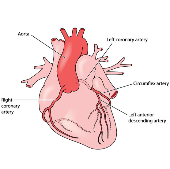Coronary Artery Aneurysm