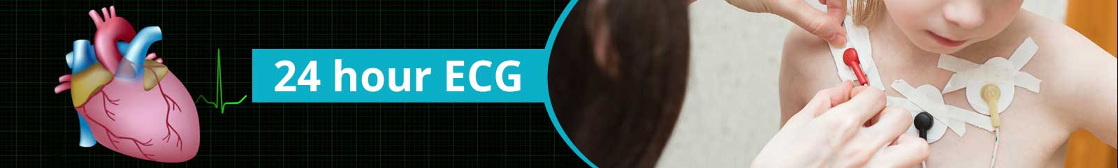24 Hour ECG